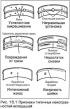 Осмотр коренных и шатунных подшипников